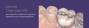 exocad for dentists header