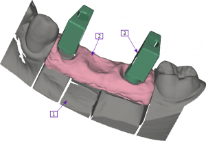 Implant ScanAdaptors